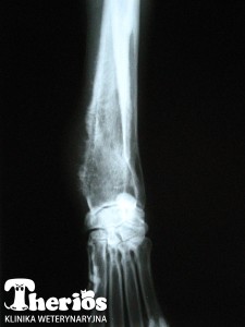 Zdjęcie rentgenowskie chorej kończyny - projekcja strzałkowa