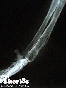 Zdjęcie rentgenowskie chorej kończyny - projekcja boczna