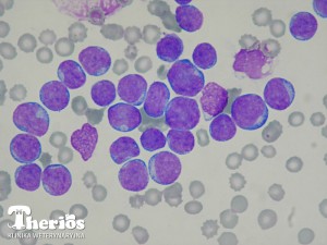 Rozmaz krwi - widoczne liczne blasty (ostra białaczka limfoblastyczna u psa).