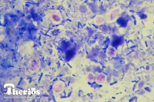 Badanie cytologiczne kału pomaga stwierdzić obecność endospor clostridium sp. Na zdjęciu: kał psa myśliwskiego zakażonego beztlenowcami i algami