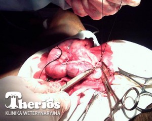 Podwiązanie kikuta więzadła i tętnicy jajnikowej