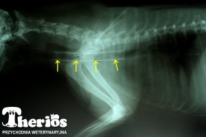 Zdjęcie rtg: żółtymi strzałkami zaznaczony stent (implant) dotchawiczy